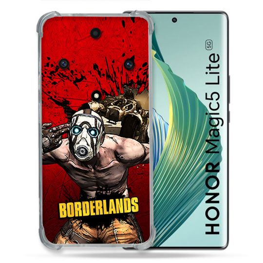 Coque Pour Huawei Honor Magic 5 Lite Borderland