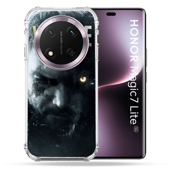 Coque Renforcée Pour Honor Magic 7 Lite 5G Resident Evil