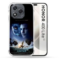 Coque Renforcée Pour Honor 400 Lite 5G Avatar