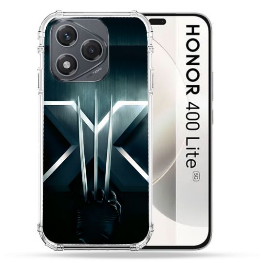 Coque Renforcée Pour Honor 400 Lite 5G Xmen