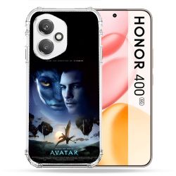 Coque Renforcée Pour Honor 400 5G Avatar