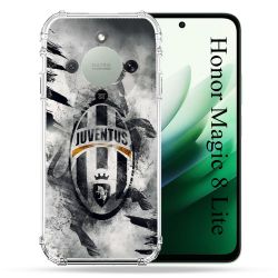 Coque Renforcée Pour Honor Magic 8 Lite 5G Foot Juventus Turin
