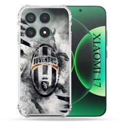 Coque Renforcée Pour Xiaomi 17 Foot Juventus Turin