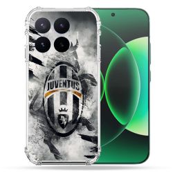 Coque Renforcée Pour Xiaomi 17T Pro Foot Juventus Turin
